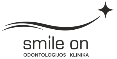 Odontologijos klinika šiauliuose SmileON, dantų implantavimas ir dantų balinimas